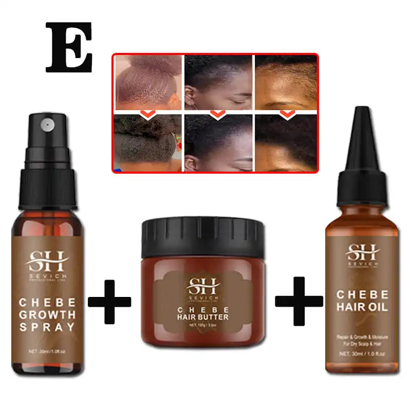 Sevich Chebe Hair Loss Treatment Spray Traction Alopecia Chebe Powder Essential Oil Africa Crazy Hair Growth Products Hair Care